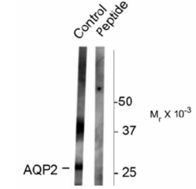 Western Blot: Aquaporin-2 [p Ser261] Antibody [NB100-61100]